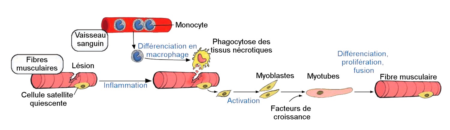 Les lésions musculaires